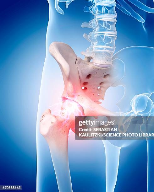 human hip pain - hip pain stock illustrations