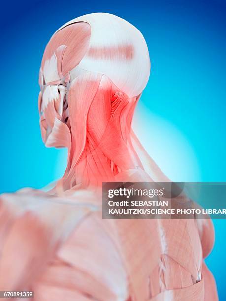 human neck pain - neck muscle pain illustration stock illustrations