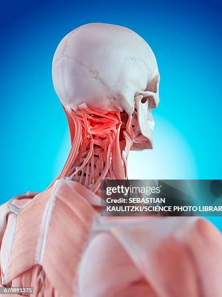 human neck pain - neck muscle pain illustration stock illustrations
