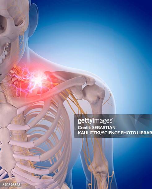 human nerve pain - nerve pain stock illustrations