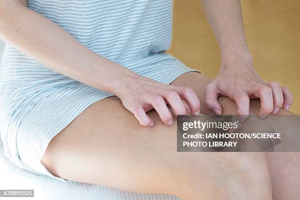 woman scratching her legs - thigh stock pictures, royalty-free photos & images