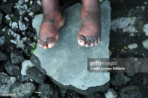 Sifa sits in the Heal Africa shelter in Goma about six months after she was raped in a town in eastern Congo, North Kivu, April 10, 2008. Sifa said...