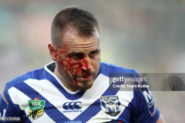 Josh Reynolds of the Bulldogs bleeds from a cut on his cheek during the round eight NRL match between the Wests Tigers and the Canterbury Bulldogs at...