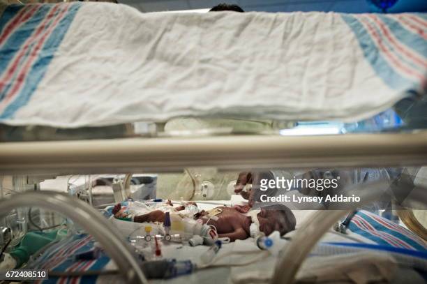 Terry Coates, touches her four day old grandchild, Tayden Coates, in the incubator in the in the Neo-natal Intensive care unit at the University...