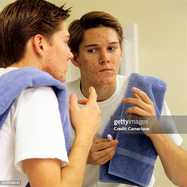 1980s TEEN BOY WITH ACNE APPLYING PIMPLE MEDICATION LOOKING IN BATHROOM MIRROR