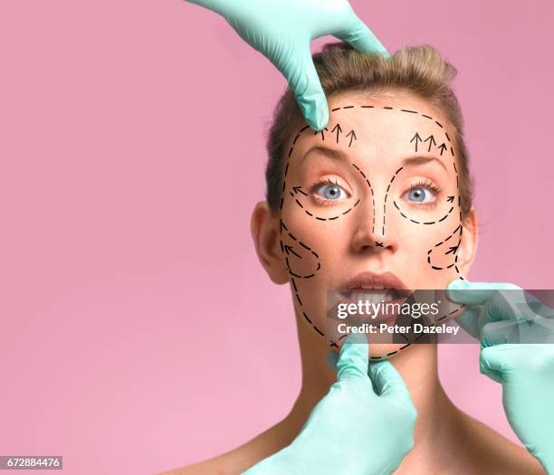 plastic surgeon marking up for surgery - tratamento a laser imagens e fotografias de stock