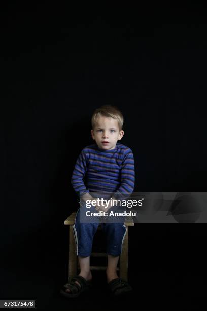 Year-old wounded Syrian war victim Alef Cerf, who fled from his house due to ongoing civil war, is seen in Gaziantep, Turkey on April 12, 2017. Alef...