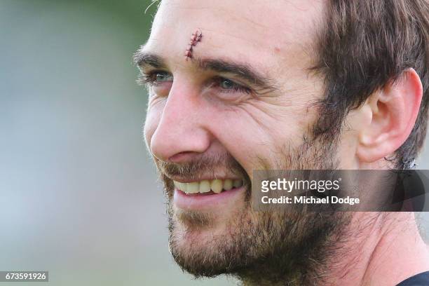 Jobe Watson of the Bombers looks upfield with stitches in his forehand from the Anzac Day match during an Essendon Bombers AFL training session at...