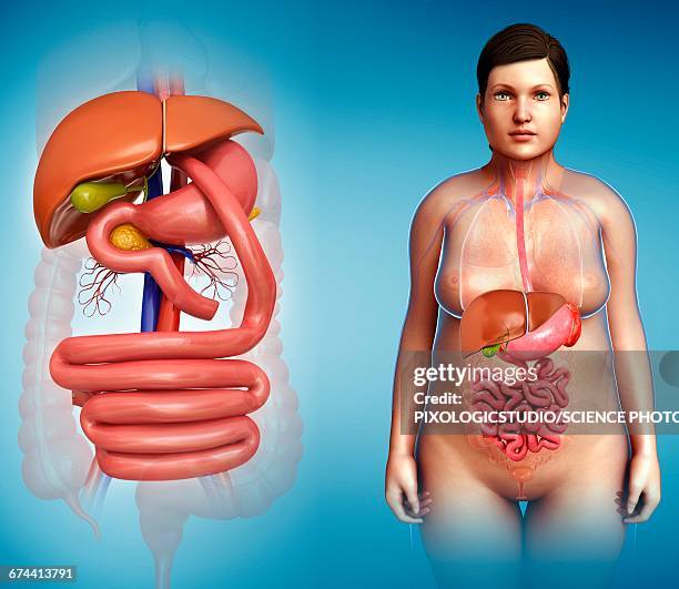 gastric bypass, illustration - gastric bypass stock illustrations