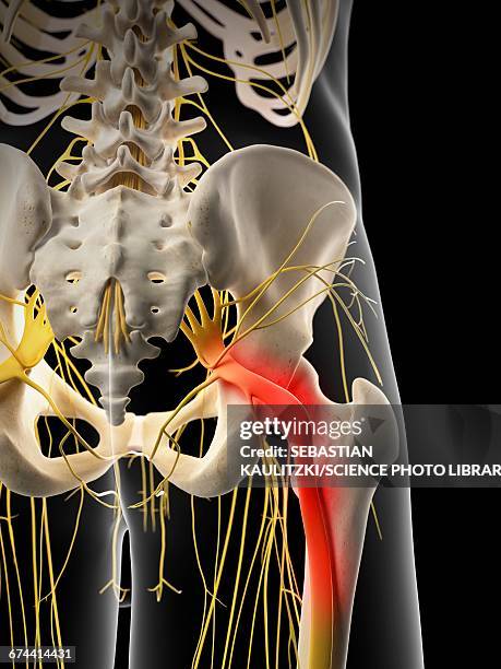 ilustraciones, imágenes clip art, dibujos animados e iconos de stock de sciatic nerve pain - sciatic