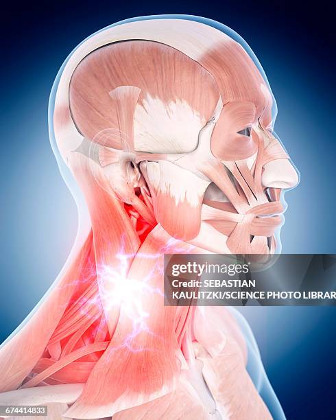 neck pain - neck muscle pain illustration stock illustrations