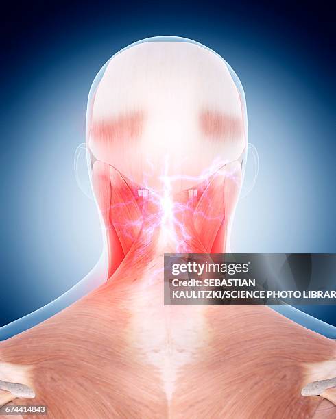 neck pain - neck muscle pain illustration stock illustrations