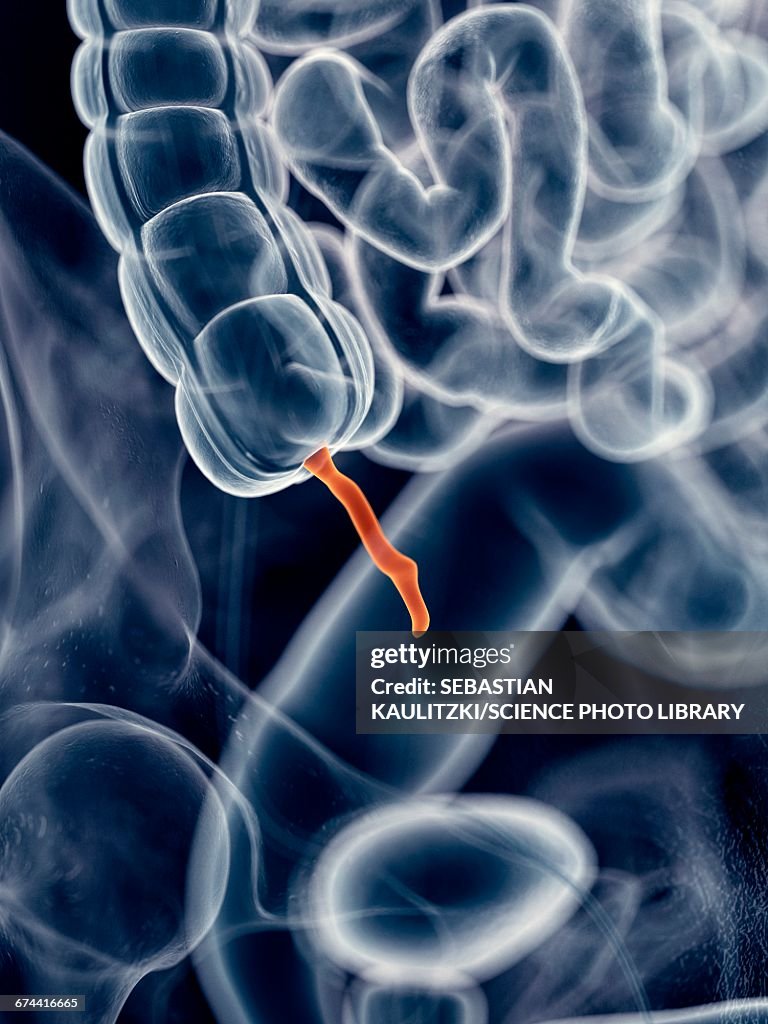 Human Appendix High-Res Vector Graphic - Getty Images