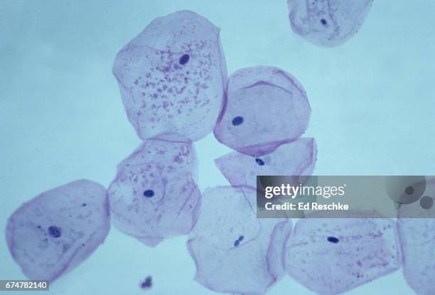 squamous epitheial cells (check cells) - cellulose fotografías e imágenes de stock