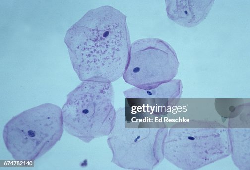 Squamous Epitheial Cells (Check cells) Squamous Epitheial Cells (Check cells)