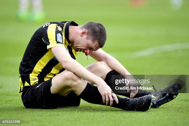 Vitesse's Dutch defender Arnold Kruiswijk reacts as his nose bleeds after colliding with an AZ Alkmaar player during the Dutch Cup final football...