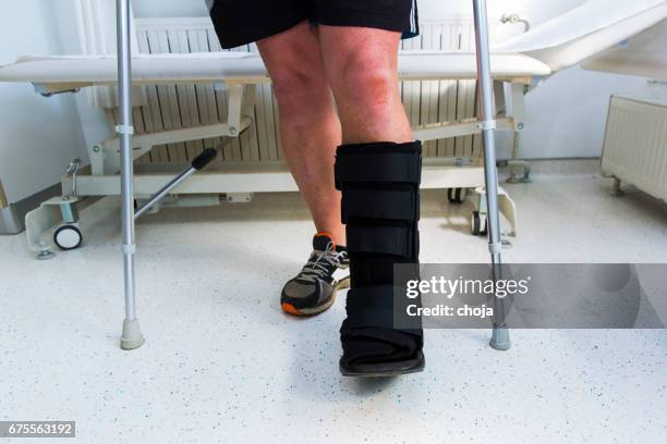 muscular athlete with walking boot for achilles tendon treatment - nylon fastening tape stock pictures, royalty-free photos & images