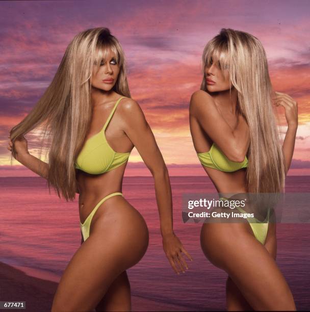 Pinups Shane and Sia Barbi reveal their life-and-death struggle with eating disorders in their new book "Dying To Be Healthy" January 29, 2001 in Los...