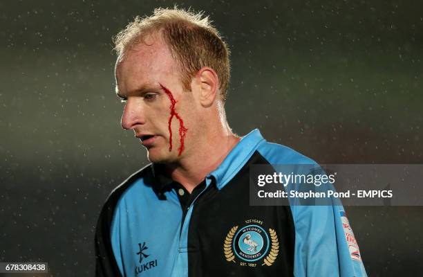 Wycombe Wanderers' Gary Doherty receives treatment for a bloody head