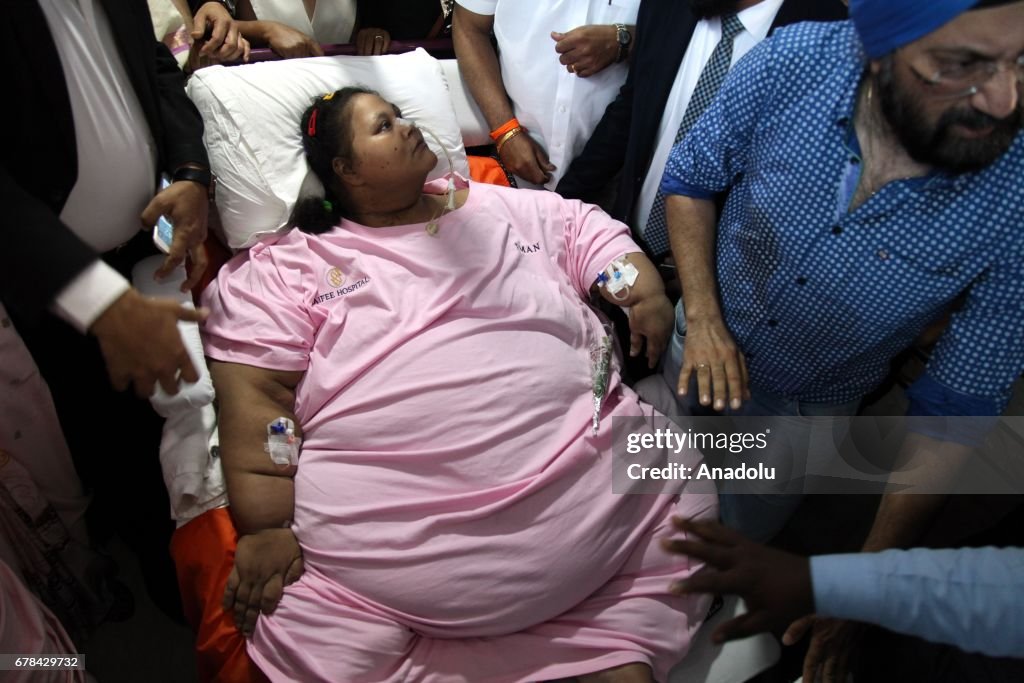 Egyptian woman Emam Ahmed who was undergoing weight-loss surgery...