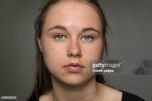 フィルタ リングされていない、リアル思春期の 10 代の少女 - sad face ストックフォトと画像