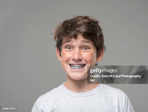 smiling caucasian boy with braces - braces stock pictures, royalty-free photos & images