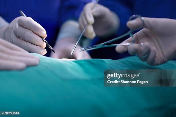 hands of operating room staff performing surgery - operating ストックフォト��と画像