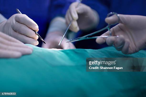 hands of operating room staff performing surgery - equipamento cirúrgico imagens e fotografias de stock