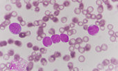 blood smear is often used as a follow-up test to abnormal