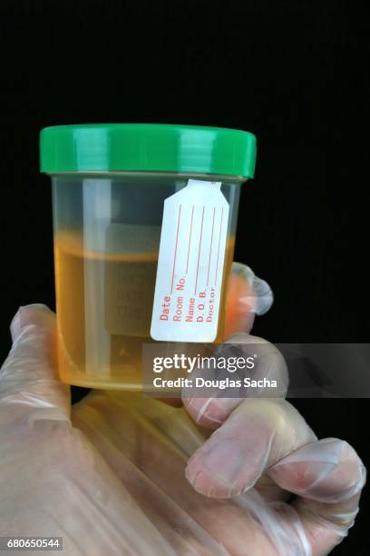 human fluid sample at the testing clinic - cholesterol test stock pictures, royalty-free photos & images