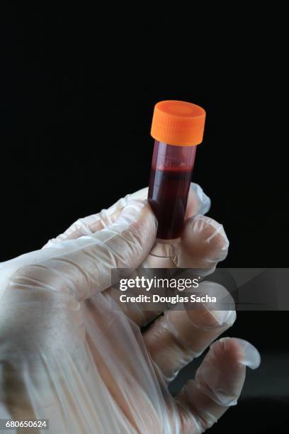 medical technician hold sample blood for testing - exame de drogas - fotografias e filmes do acervo