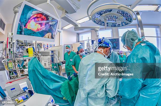 cardiac surgeons and nurses in the operation room - heart surgery stock pictures, royalty-free photos & images