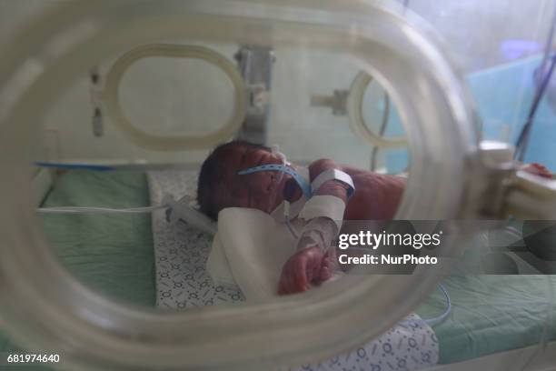 Prematurity Palestinian new born baby in Shifa Hospital in Gaza, Palestine, on 11 May 2017 suffer from a shortage of milk due to the siege....