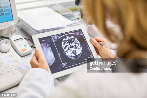 female doctor looking at x-ray report in hospital - doctor looking over shoulder stock pictures, royalty-free photos & images