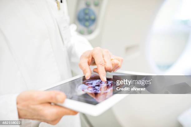 arzt analysieren röntgenbild in digital-tablette - healthcare and medicine stock-fotos und bilder