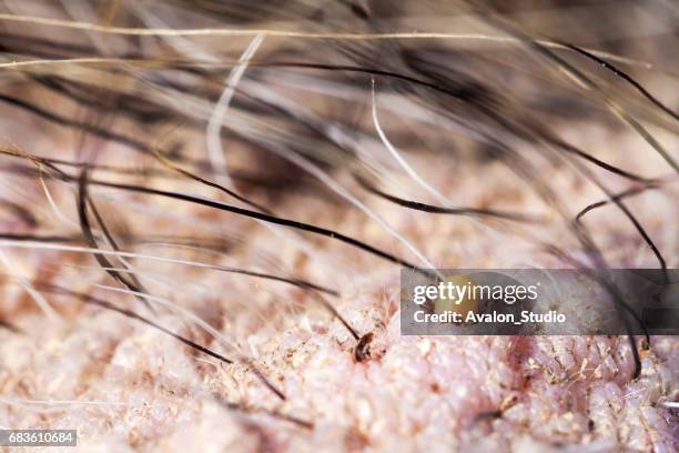 tick on animal skin. ticks caught in wild boar skin. - borreliosis stock pictures, royalty-free photos & images