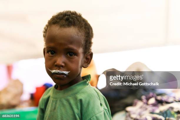 Waaf Dhuung, Ethiopia A child with remaining milk from milk powder at his mouth Unicef feeding in a village in the Somali region of Ethiopia, where...