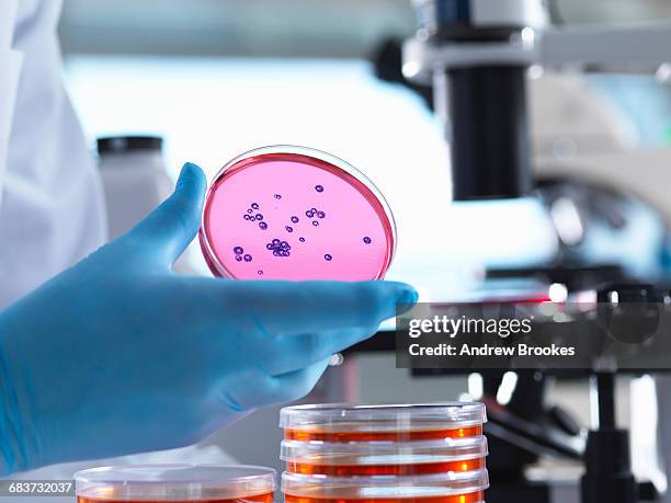 microbiology, scientist using an inverted light microscope to view culture growth in petri dishes during a experiment in a laboratory - bacterie stockfoto's en -beelden