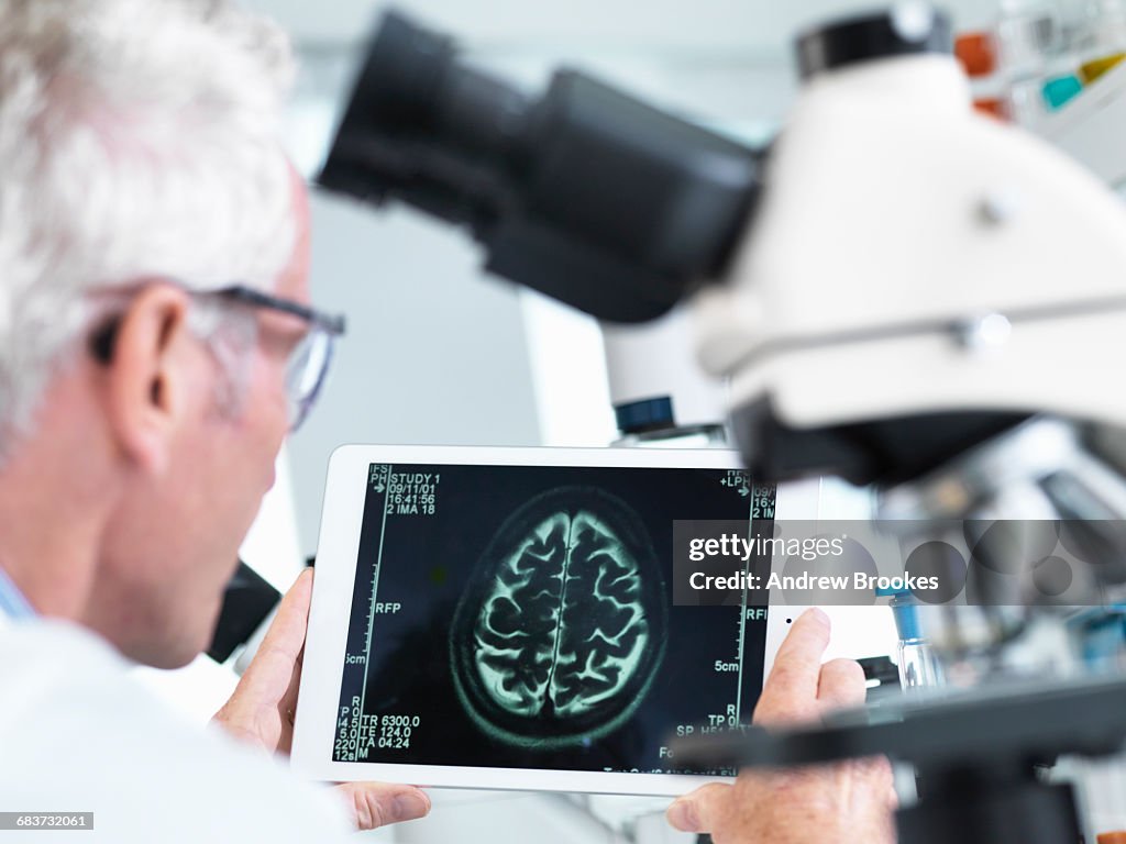 Doctor viewing a MRI brain scan on digital tablet in a laboratory