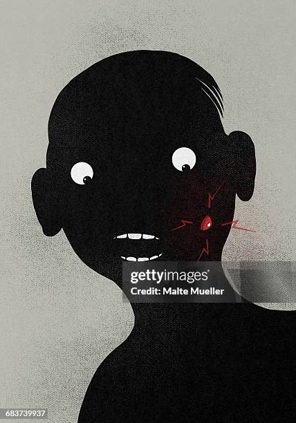 illustration of man with pimple on face - acne stock-grafiken, -clipart, -cartoons und -symbole