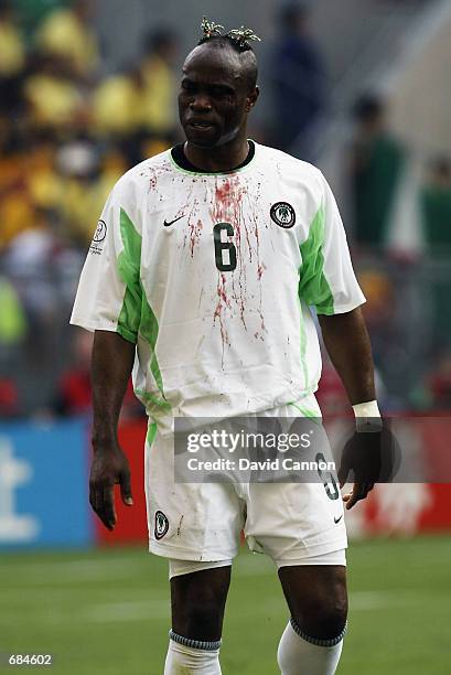 Taribo West of Nigeria after a clash of heads during the FIFA World Cup Finals 2002 Group F match between Sweden and Nigeria played at the Kobe Wing...