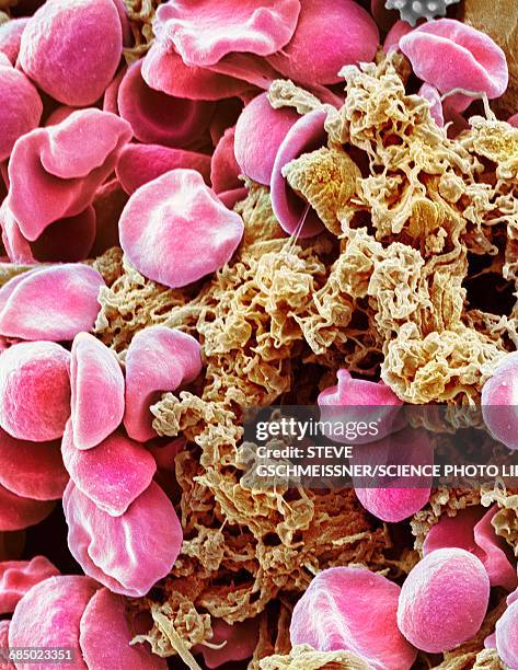 red blood cells and platelets, sem - micrografia elettronica a scansione foto e immagini stock