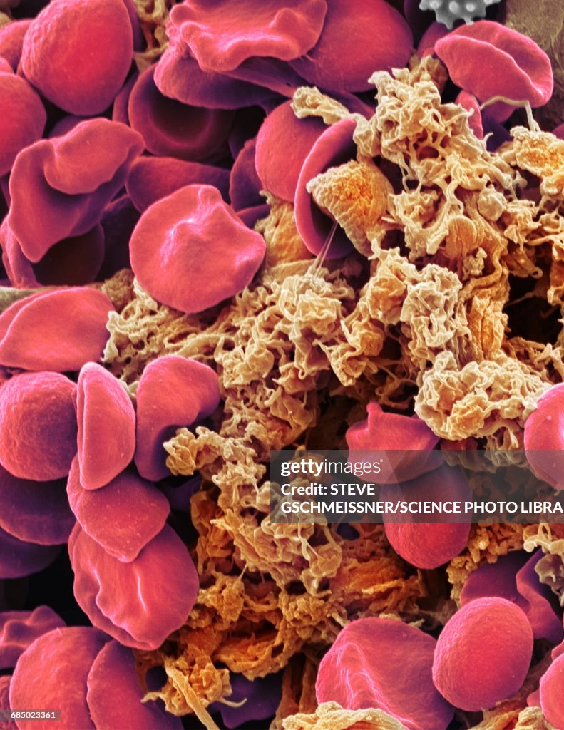 Red blood cells and platelets, SEM
