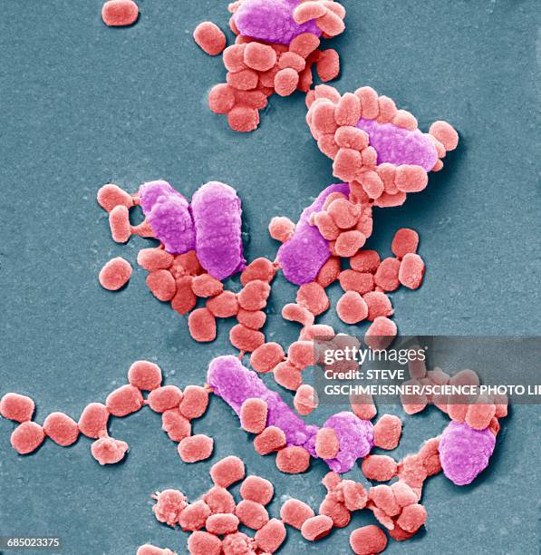 virus particles and bacteria, sem - micrografía electrónica escaneadora fotografías e imágenes de stock