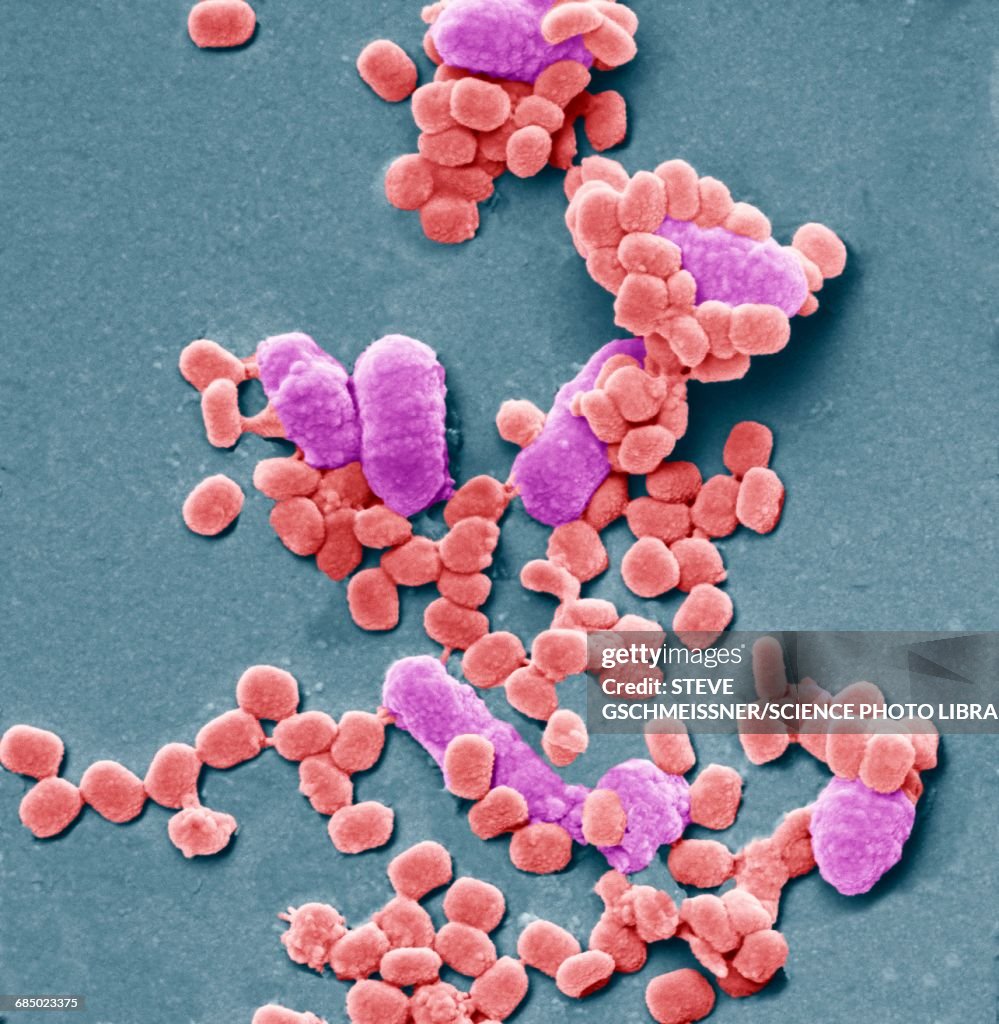 Virus particles and bacteria, SEM