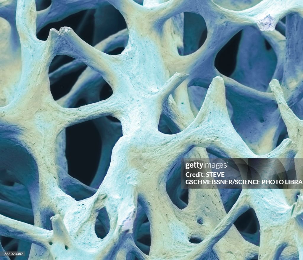 Bone tissue, SEM