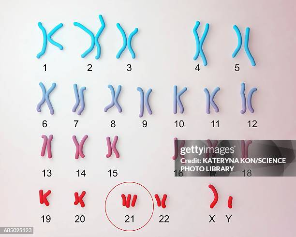 downs syndrome karyotype, illustration - chromosome stock-grafiken, -clipart, -cartoons und -symbole