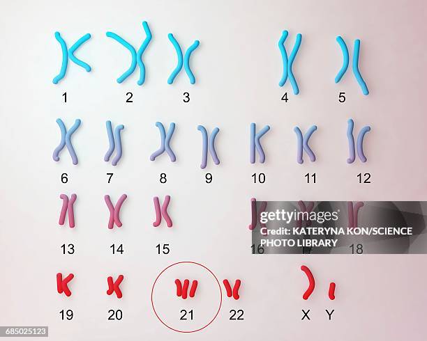 ilustrações, clipart, desenhos animados e ícones de downs syndrome karyotype, illustration - cromossoma