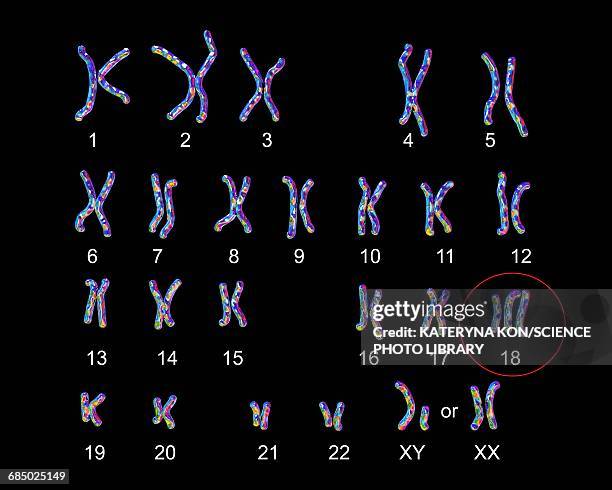 illustrations, cliparts, dessins animés et icônes de edwards syndrome karyotype, illustration - chromosome
