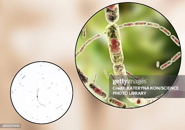 anthrax bacteria, illustration - light micrograph stock illustrations